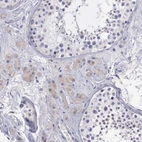 Immunohistochemical staining of human testis shows moderate cytoplasmic positivity in Leydig cells.