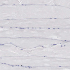 Immunohistochemical staining of human skeletal muscle shows no positivity in myocytes as expected.