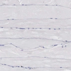 Immunohistochemical staining of human skeletal muscle shows no positivity in myocytes as expected.