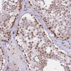 Immunohistochemical staining of human testis shows moderate to strong nuclear positivity in cells in seminiferous ducts.