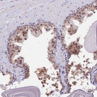 Immunohistochemical staining of human prostate shows weak to moderate nuclear positivity in glandular cells.