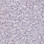 Immunohistochemical staining of human liver shows no positivity in hepatocytes as expected.