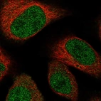 Immunofluorescent staining of human cell line U-2 OS shows localization to nucleoplasm.