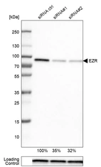 Western blot analysis in U-251MG cells transfected with control siRNA, target specific siRNA probe #1 and #2, using Anti-EZR antibody. Remaining relative intensity is presented. Loading control: Anti-GAPDH.