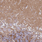 Immunohistochemical staining of human cerebellum shows strong cytoplasmic positivity in neuropil.