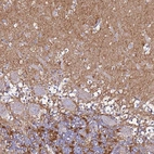 Immunohistochemical staining of human cerebellum shows strong cytoplasmic positivity in neuropil.