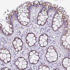Immunohistochemical staining of human colon shows moderate cytoplasmic granular positivity in glandular cells.