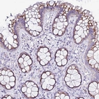 Immunohistochemical staining of human colon shows moderate cytoplasmic granular positivity in glandular cells.