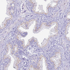 Immunohistochemical staining of human prostate shows moderate cytoplasmic granular positivity in glandular cells.