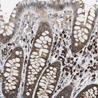 Immunohistochemical staining of human colon shows strong cytoplasmic positivity in glandular cells.