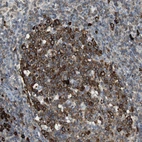 Immunohistochemical staining of human lymph node shows strong cytoplasmic positivity in germinal center cells.