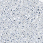 Immunohistochemical staining of human liver shows no positivity in hepatocytes as expected.