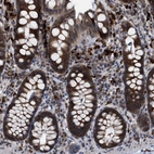 Immunohistochemical staining of human colon shows strong cytoplasmic positivity in glandular cells.