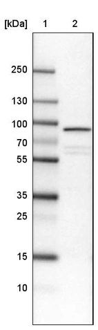 Lane 1: Marker [kDa]_br/_Lane 2: Human cell line U-251 MG