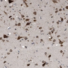 Immunohistochemical staining of human cerebral cortex shows strong cytoplasmic positivity in neurons.