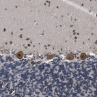 Immunohistochemical staining of human cerebellum shows strong cytoplasmic and nuclear positivity in Purkinje cells.