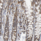 Immunohistochemical staining of human rectum shows strong cytoplasmic granular positivity in glandular cells.
