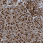 Immunohistochemical staining of human pancreas shows strong cytoplasmic granular positivity in exocrine glandular cells.