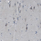 Immunohistochemical staining of human cerebral cortex shows moderate cytoplasmic positivity in neurons.