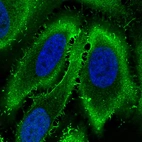 Immunofluorescence staining in HeLa cell line with Anti-EZR monoclonal antibody, showing specific staining of plasma membrane in green. Microtubule- and nuclear probes are visualized in red and blue respectively (where available).