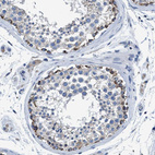 Immunohistochemical staining of human testis shows moderate cytoplasmic positivity in a subset of cells in seminiferous ducts.