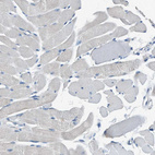 Immunohistochemical staining of human skeletal muscle shows no positivity in myocytes as expected.