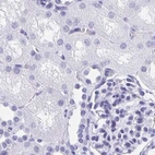 Immunohistochemical staining of human kidney using Anti-HDGFL1 antibody HPA045679.