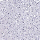 Immunohistochemical staining of human liver shows no positivity in hepatocytes as expected.