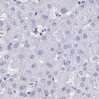 Immunohistochemical staining of human liver using Anti-HDGFL1 antibody HPA045679.