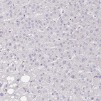Immunohistochemical staining of human liver shows no positivity in hepatocytes as expected.