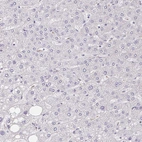 Immunohistochemical staining of human liver shows no positivity in hepatocytes as expected.