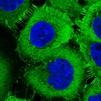 Immunofluorescence staining in A431 cell line with Anti-EZR monoclonal antibody, showing specific staining of plasma membrane in green. Microtubule- and nuclear probes are visualized in red and blue respectively (where available).