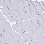 Immunohistochemical staining of human skeletal muscle shows no positivity in myocytes as expected.