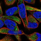Immunofluorescent staining of human cell line RH-30 shows localization to cytosol.