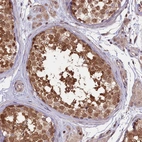 Immunohistochemical staining of human testis shows strong cytoplasmic positivity in cells in seminiferous ducts.