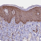 Immunohistochemical staining of human skin shows strong cytoplasmic positivity in squamous epithelial cells.