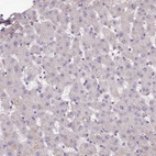 Immunohistochemical staining of human liver shows very weak positivity in hepatocytes.