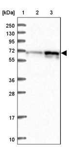 Lane 1: Marker [kDa] 250, 130, 95, 72, 55, 36, 28, 17, 10_br/_Lane 2: Human cell line RT-4_br/_Lane 3: Human cell line U-251MG sp