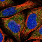 Immunofluorescent staining of human cell line U-2 OS shows localization to cytosol.