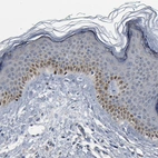 Immunohistochemical staining of human skin shows moderate nuclear positivity in squamous epithelial cells.