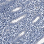 Immunohistochemical staining of human endometrium shows no positivity in glandular cells as expected.