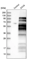 Western blot analysis in control (vector only transfected HEK293T lysate) and SOX6 over-expression lysate (Co-expressed with a C-terminal myc-DDK tag (~3.1 kDa) in mammalian HEK293T cells, LY403243).