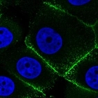 Immunofluorescence staining in MCF7 cell line with Anti-EZR monoclonal antibody, showing specific staining of plasma membrane in green. Microtubule- and nuclear probes are visualized in red and blue respectively (where available).