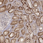 Immunohistochemical staining of human kidney shows strong cytoplasmic granular positivity in cells in tubules.