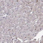 Immunohistochemical staining of human liver shows no positivity in hepatocytes as expected.