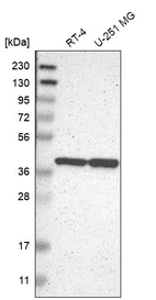 Western blot analysis in human cell line RT-4 and human cell line U-251 MG.