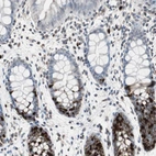 Immunohistochemical staining of human colon shows strong nuclear positivity in glandular cells.