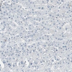 Immunohistochemical staining of human liver shows no positivity in hepatocytes as expected.