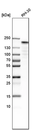 Western blot analysis in human cell line RH-30.