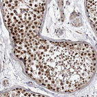 Immunohistochemical staining of human testis shows strong nuclear positivity in cells in seminiferous ducts.